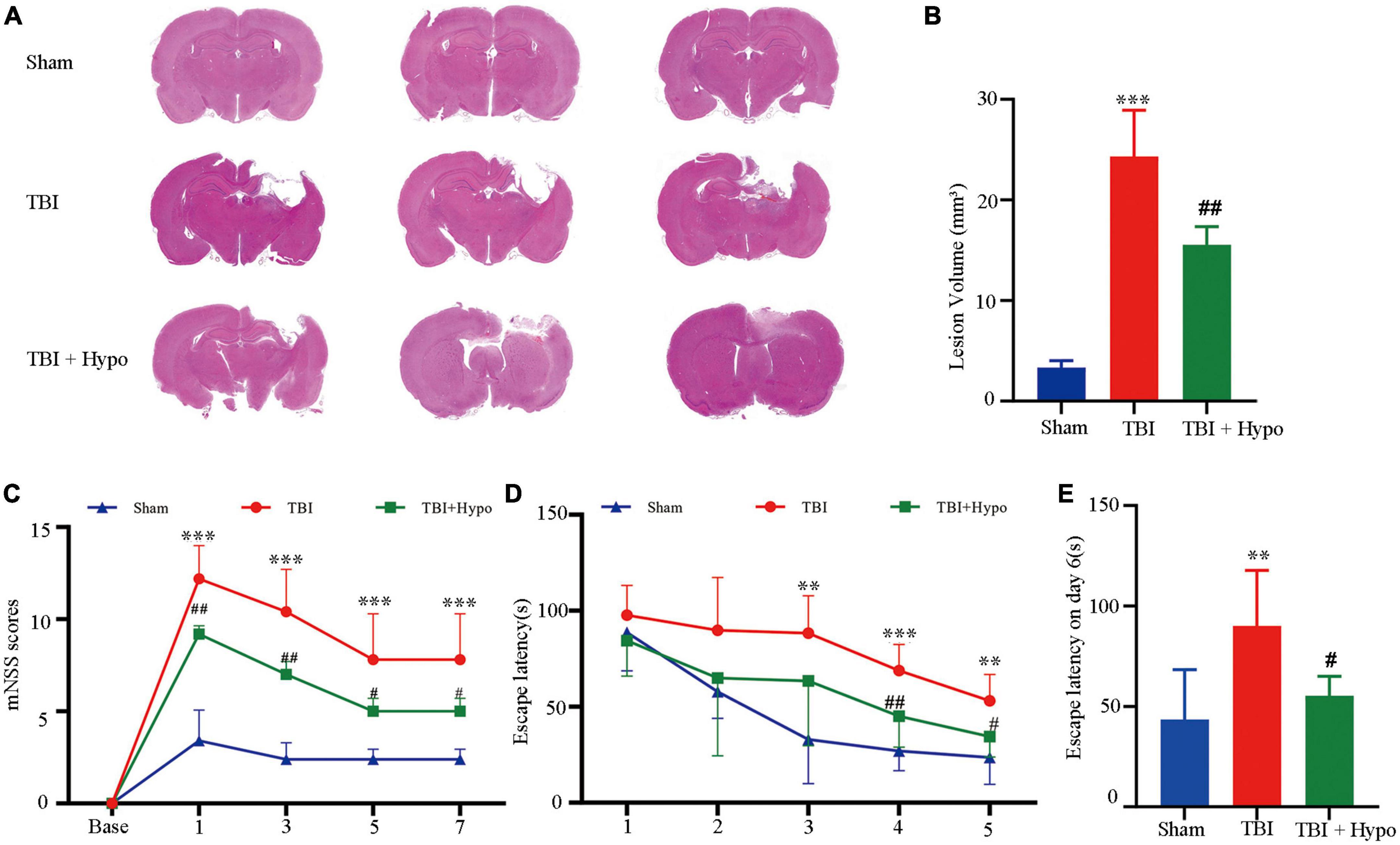 N6-methyladenosine RNA is modified in the rat hippocampus following traumatic brain injury with hypothermia treatment